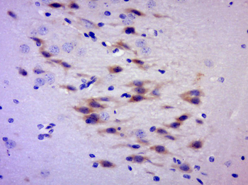 C2orf55 Rabbit Polyclonal Antibody