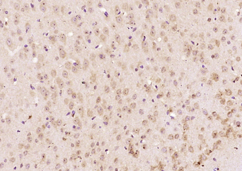 BBS5 Rabbit Polyclonal Antibody
