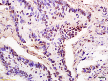 THOC2 Rabbit Polyclonal Antibody