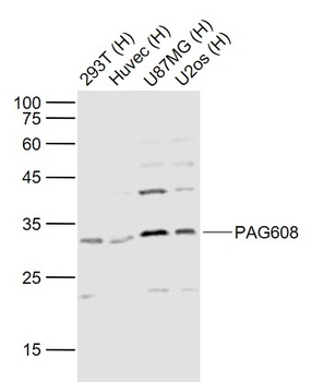 WIG 1 antibody