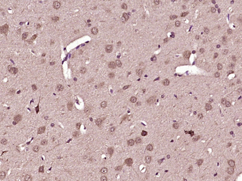 C21orf2 Rabbit Polyclonal Antibody