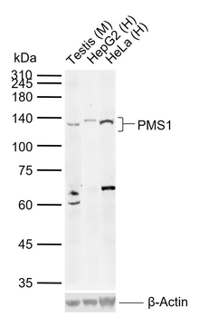 PMS1 Rabbit Polyclonal Antibody