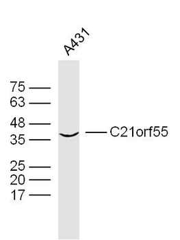 C21orf55 Rabbit Polyclonal Antibody