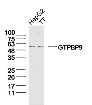 GTPBP9 Rabbit Polyclonal Antibody