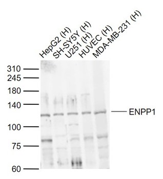 ENPP1 Rabbit Polyclonal Antibody