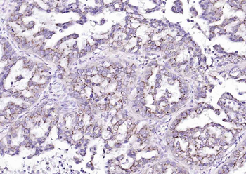 KCNMA1/BK channel Rabbit Polyclonal Antibody