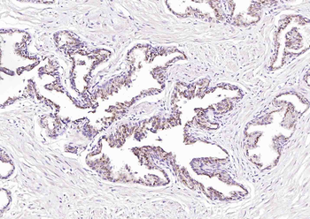 KCNMA1/BK channel Rabbit Polyclonal Antibody