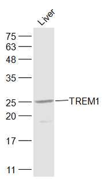 TREM1 Rabbit Polyclonal Antibody