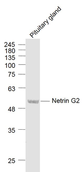 Netrin G2 Rabbit Polyclonal Antibody