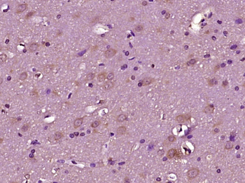 NRXN2 Rabbit Polyclonal Antibody