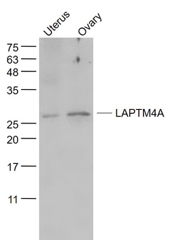 LAPTM4A Rabbit Polyclonal Antibody