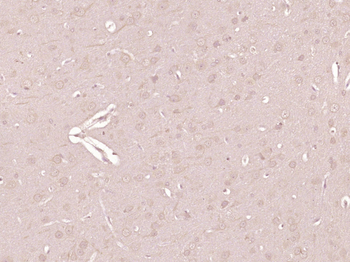 Junctophilin 4 Rabbit Polyclonal Antibody