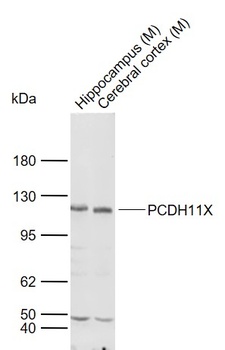 PCDH11X antibody