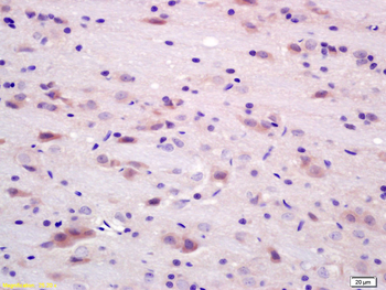 ABCG2 Rabbit Polyclonal Antibody
