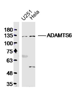 ADAMTS6 Rabbit Polyclonal Antibody