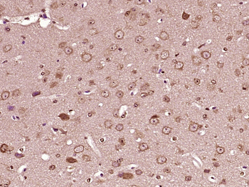 Collagen X Rabbit Polyclonal Antibody