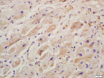 Collagen X Rabbit Polyclonal Antibody