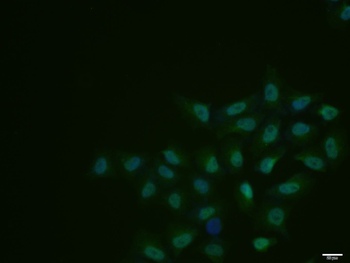 Phospho-CDK7 (Thr170) Rabbit Polyclonal Antibody