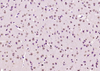 KIAA2022 Rabbit Polyclonal Antibody