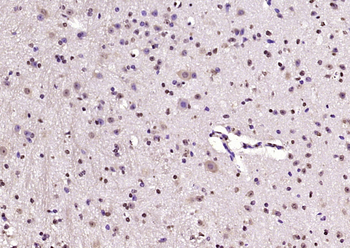 KIAA2022 Rabbit Polyclonal Antibody