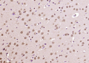 KIAA2022 Rabbit Polyclonal Antibody