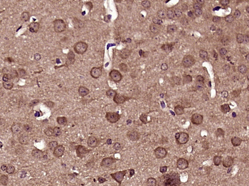 Phospho-DNM1L (Ser616) Rabbit Polyclonal Antibody