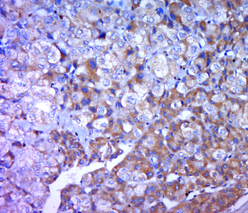 FGA Rabbit Polyclonal Antibody
