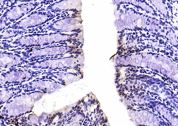 Phospho-FoxO1 (Ser319) Rabbit Polyclonal Antibody