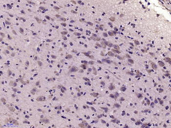 GSK3A Rabbit Polyclonal Antibody