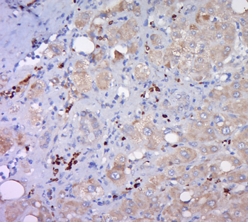 HDLBP Rabbit Polyclonal Antibody