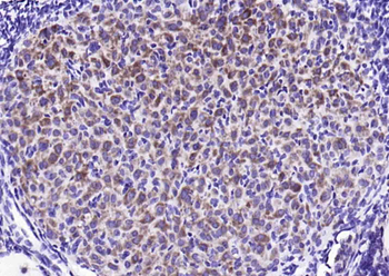 STMN1 Rabbit Polyclonal Antibody