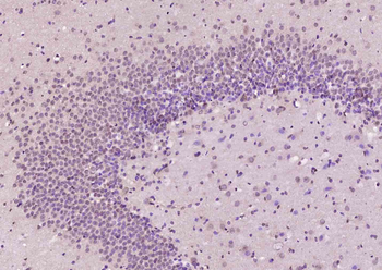 MTA3 Rabbit Polyclonal Antibody