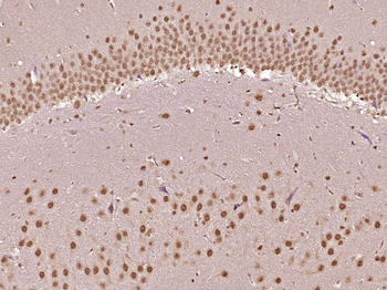 NSMCE4A Rabbit Polyclonal Antibody