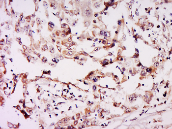NSUN6 Rabbit Polyclonal Antibody