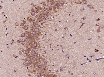 NFE2L1 Rabbit Polyclonal Antibody