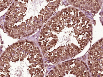 NUDCD1 Rabbit Polyclonal Antibody