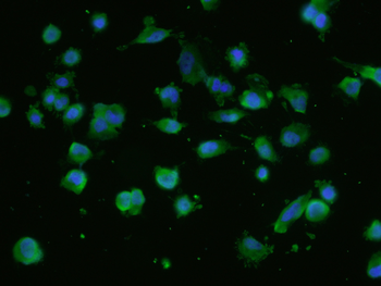 NUP214 Rabbit Polyclonal Antibody