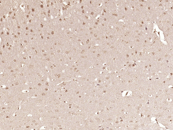 OASL/TRIP14 Rabbit Polyclonal Antibody
