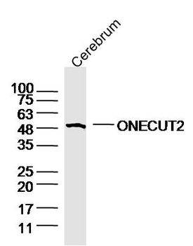 ONECUT2 Rabbit Polyclonal Antibody
