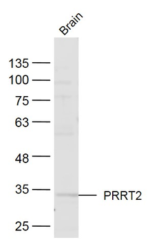 PRRT2 Rabbit Polyclonal Antibody