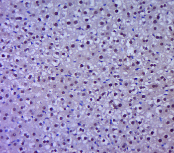 PRSS23 Rabbit Polyclonal Antibody