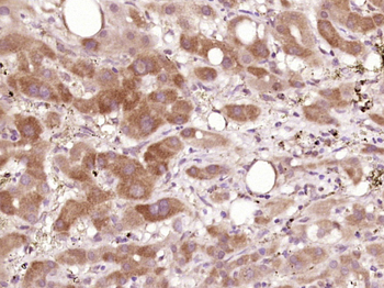 PSG6 Rabbit Polyclonal Antibody