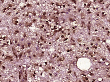 PSMC3 Rabbit Polyclonal Antibody