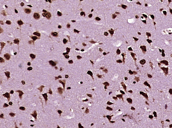 PSMC3 Rabbit Polyclonal Antibody