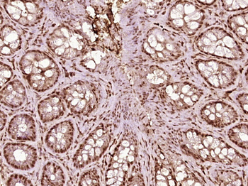 PSMC3IP Rabbit Polyclonal Antibody
