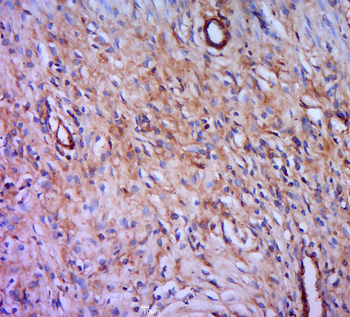 PSTPIP2 Rabbit Polyclonal Antibody