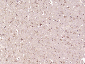 PTS Rabbit Polyclonal Antibody