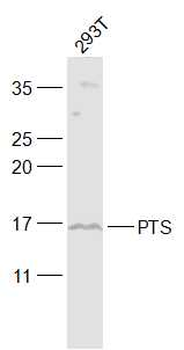 PTS Rabbit Polyclonal Antibody