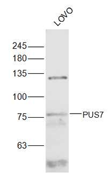 PUS7 Rabbit Polyclonal Antibody