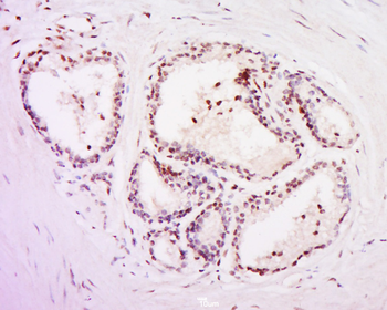 POLR3C Rabbit Polyclonal Antibody